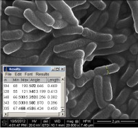 meranie-bakterie.jpg